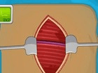 Operate Now: Pacemaker Surgery | Play on LogLod Games